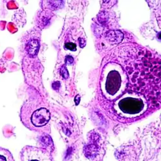 cytomegalovirus antibody igg